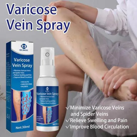 OUHOE Varicose Vein Spray Leg Circulation 30 Ml