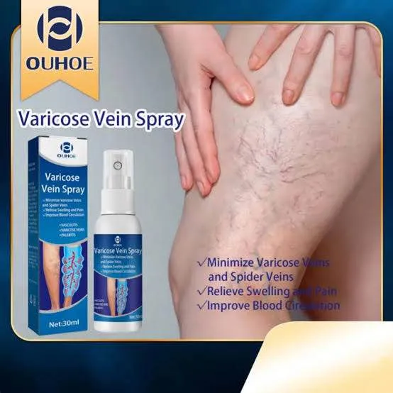 OUHOE Varicose Vein Spray Leg Circulation 30 Ml thumbnail 2